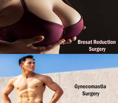 Breast Reduction / Gynecomastia