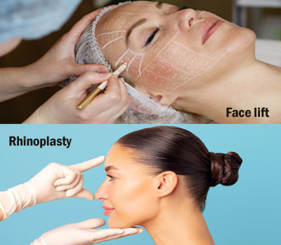 Face / Ptosis / Face Lift / Lip