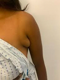 Dr Rahul Tandon Plastic surgery clinic