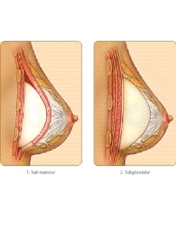 Dr Rahul Tandon Plastic surgery clinic