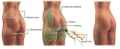 Dr Rahul Tandon Plastic surgery clinic