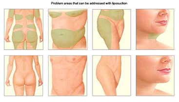 Dr Rahul Tandon Plastic surgery clinic