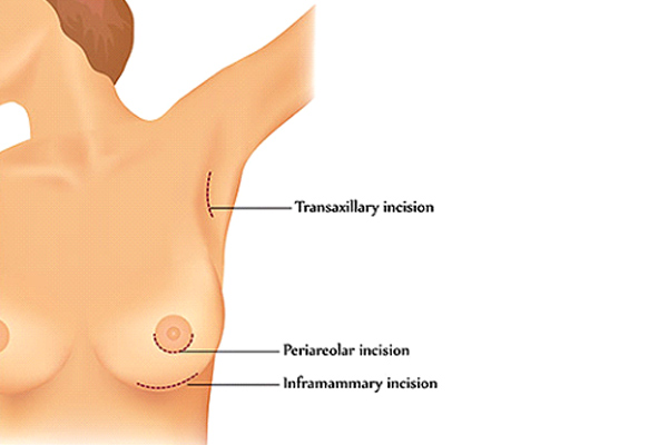 Dr Rahul Tandon Plastic surgery clinic