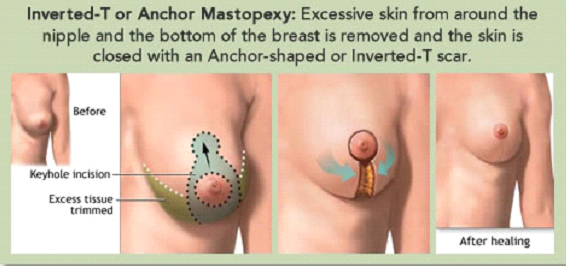 Dr Rahul Tandon Plastic surgery clinic