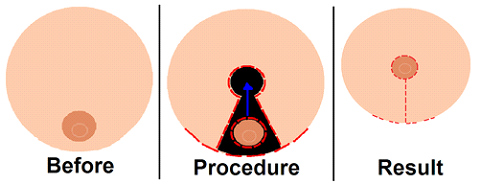 Dr Rahul Tandon Plastic surgery clinic