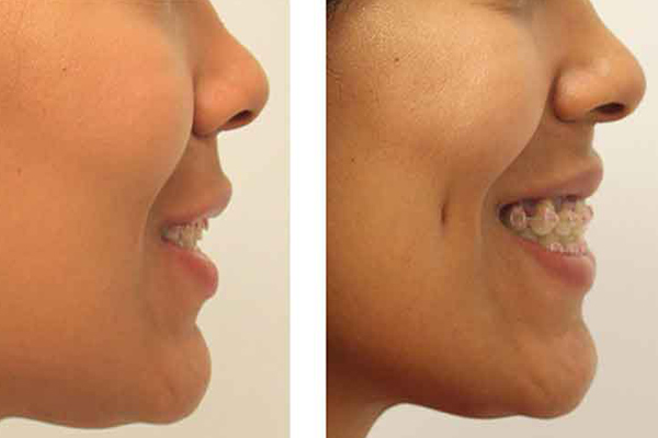 Dr Rahul Tandon Plastic surgery clinic