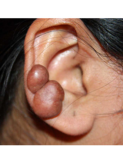 Dr Rahul Tandon Plastic surgery clinic