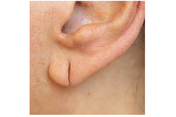 Dr Rahul Tandon Plastic surgery clinic