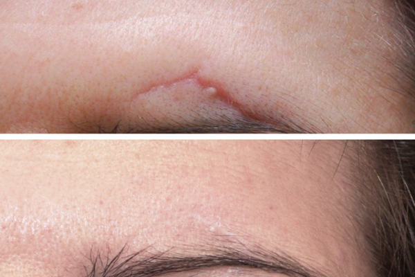 Dr Rahul Tandon Plastic surgery clinic