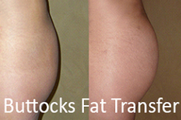Dr Rahul Tandon Plastic surgery clinic