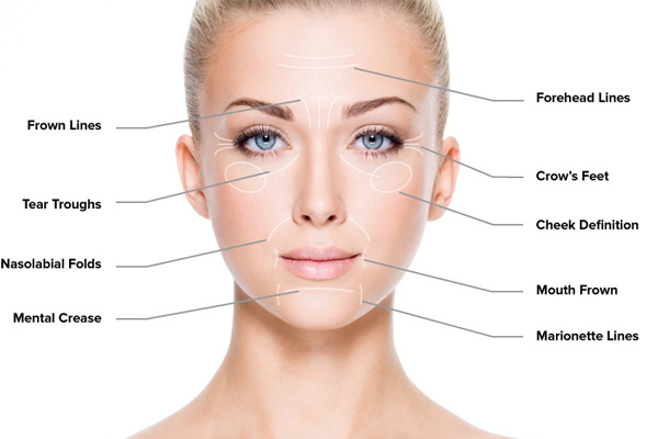 Fine wrinkles and Acne Scars
