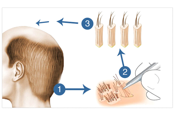 Dr Rahul Tandon Plastic surgery clinic