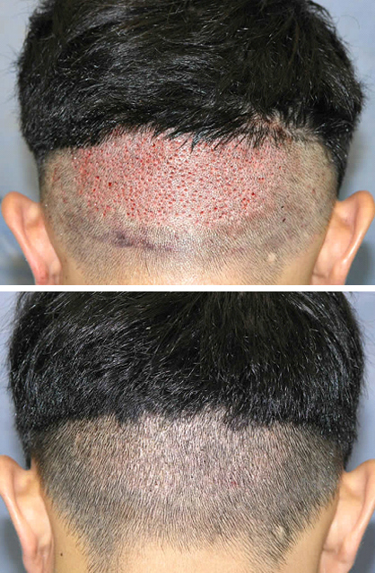 Dr Rahul Tandon Plastic surgery clinic