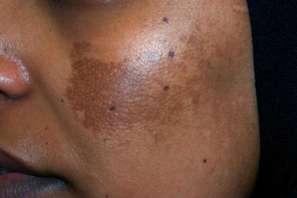 Dr Rahul Tandon Plastic surgery clinic