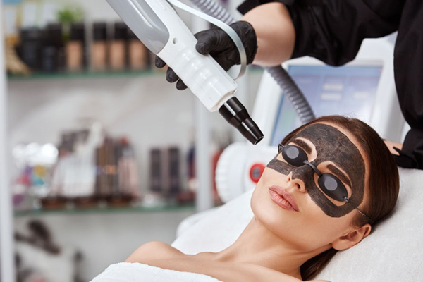Carbon Laser Facial 