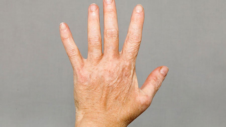 Dr Rahul Tandon Plastic surgery clinic