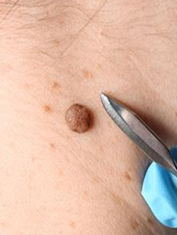 Dr Rahul Tandon Plastic surgery clinic
