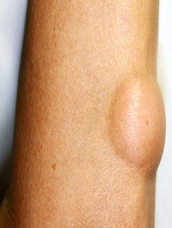 Dr Rahul Tandon Plastic surgery clinic