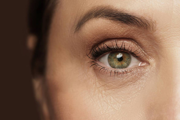 Eyelids Also known as Blepharoplasty