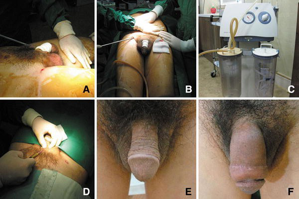 Dr Rahul Tandon Plastic surgery clinic