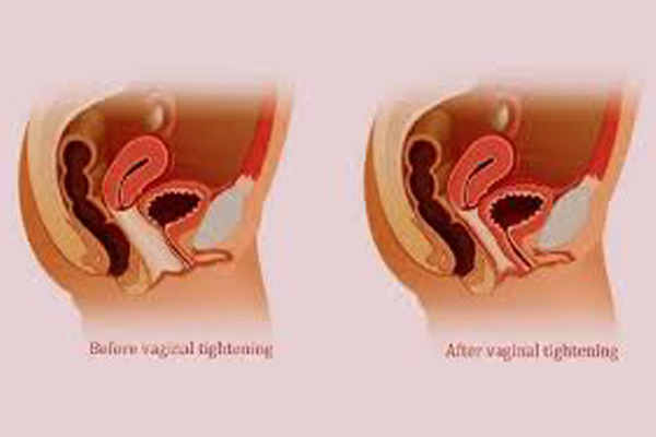 Dr Rahul Tandon Plastic surgery clinic