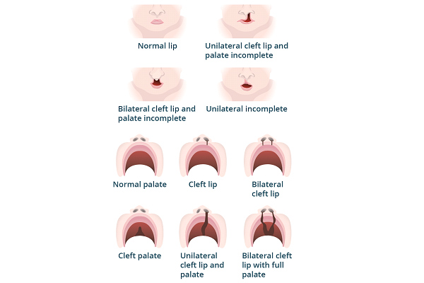 Dr Rahul Tandon Plastic surgery clinic