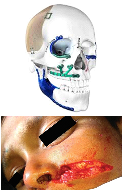 Dr Rahul Tandon Plastic surgery clinic