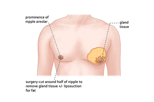 Dr Rahul Tandon Plastic surgery clinic